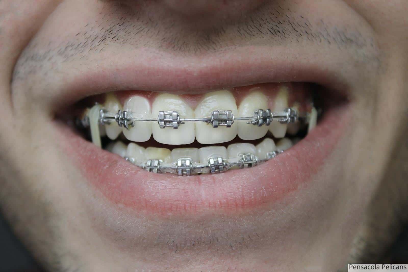 close-up of a person's mouth